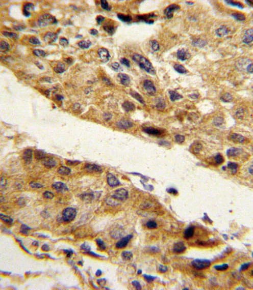 SERPINF1 / PEDF Antibody (aa9-36)
