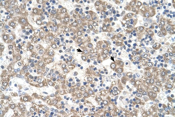 KYNU Antibody (aa251-300)