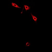 LIMS1 / PINCH Antibody