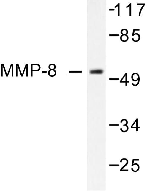 Polyclonal Rabbit anti-Human MMP8 Antibody (Phe445, IHC, WB)