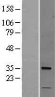 NUS1 Protein (Over-Expression Lysate Myc-DDK (Flag))