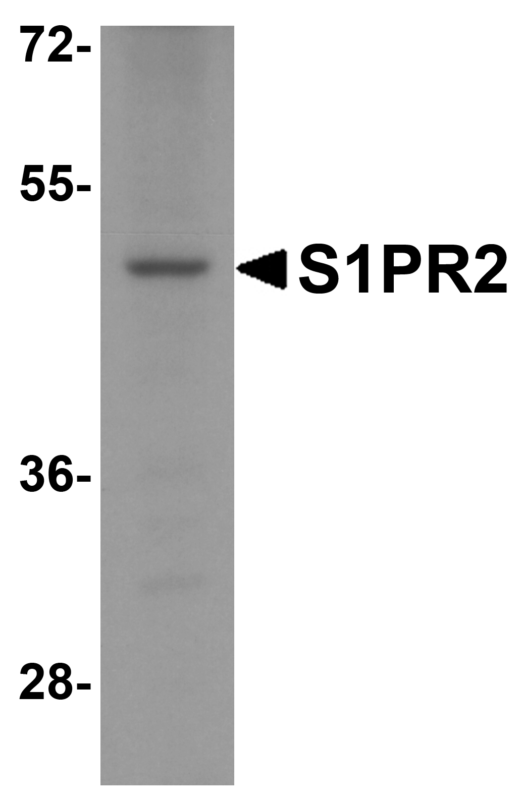SIPR2 / S1P2 / EDG5 Antibody