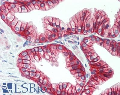 IHC-plus™ DSG2 / Desmoglein 2 Antibody