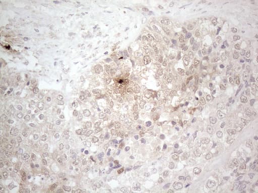 Monoclonal Mouse anti-Human ASPA Antibody (clone OTI3G5, aa77-313, IHC, WB)