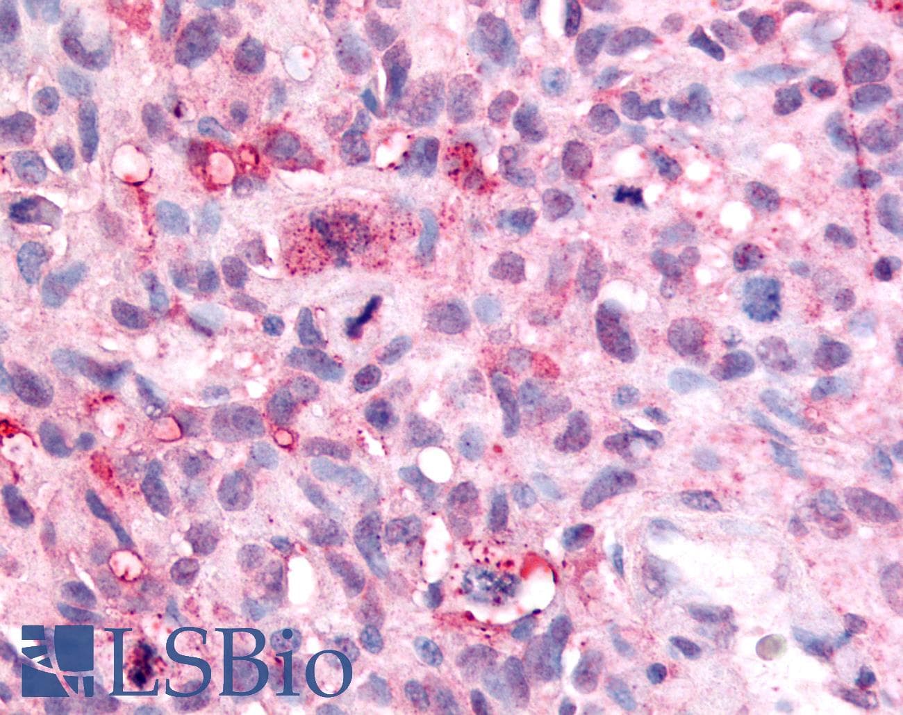 IHC-plus™ UCHL3 Antibody (C-Terminus)
