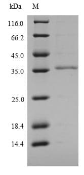 Mouse Ly6c1 Protein (Recombinant 6His-SUMO, N-terminus)