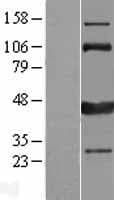 CAMK1D Protein (Over-Expression Lysate Myc-DDK (Flag))