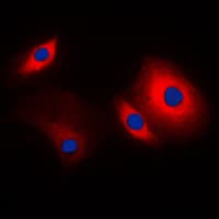 CTTN / Cortactin Antibody (C-Terminus)