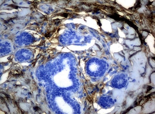 HP / Haptoglobin Antibody (clone UMAB10)