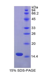 Human FASLG / Fas Ligand Protein (Recombinant His-S)