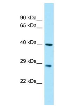 MYOZ3 Antibody (aa152-201)