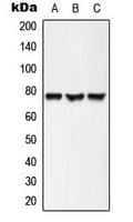 Polyclonal Rabbit anti-Human ACSL6 Antibody (Internal, IHC, WB)
