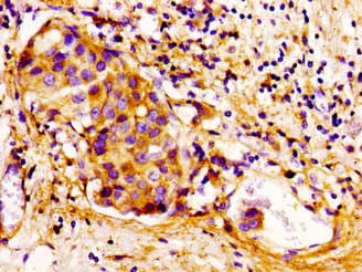CDKN3 / KAP Antibody