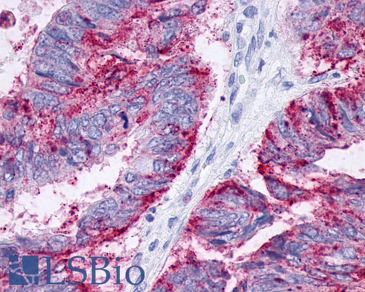 PathPlus™ Polyclonal Rabbit anti-Human F2RL3 / PAR4 Antibody (Extracellular Domain, IHC)