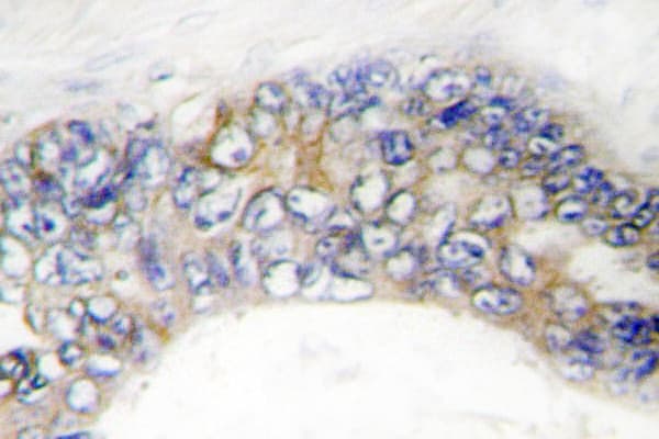 Polyclonal Rabbit anti-Human TNFRSF6B / DCR3 Antibody (Gly287, IHC, IF)
