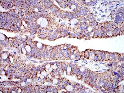 IHC-plus™ PHB / Prohibitin Antibody (clone 5H7)