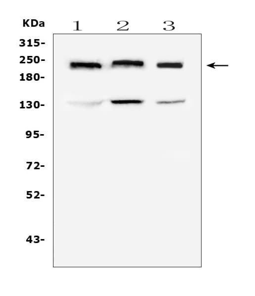 COL4A1 / Collagen IV Alpha1 Antibody