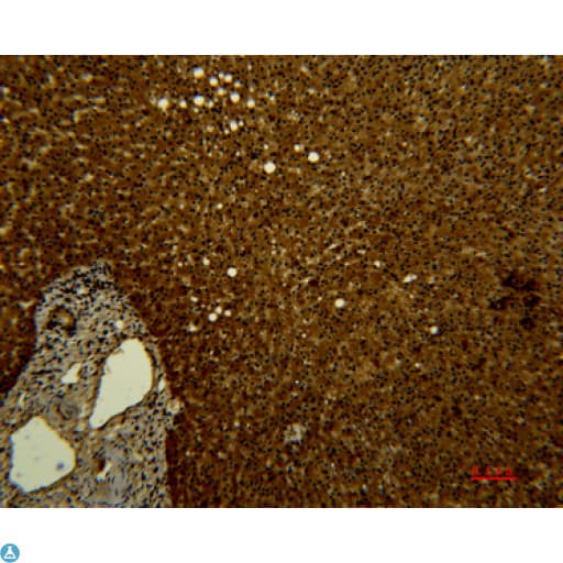 Monoclonal Mouse anti-Human TF / Transferrin Antibody (IHC, WB)