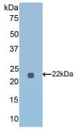 FTMT / MTF Antibody (aa54-229, PE)