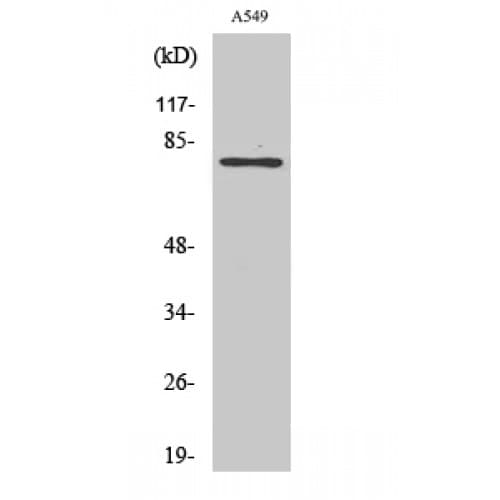PFKL Antibody (660-740 aa, C-terminal)