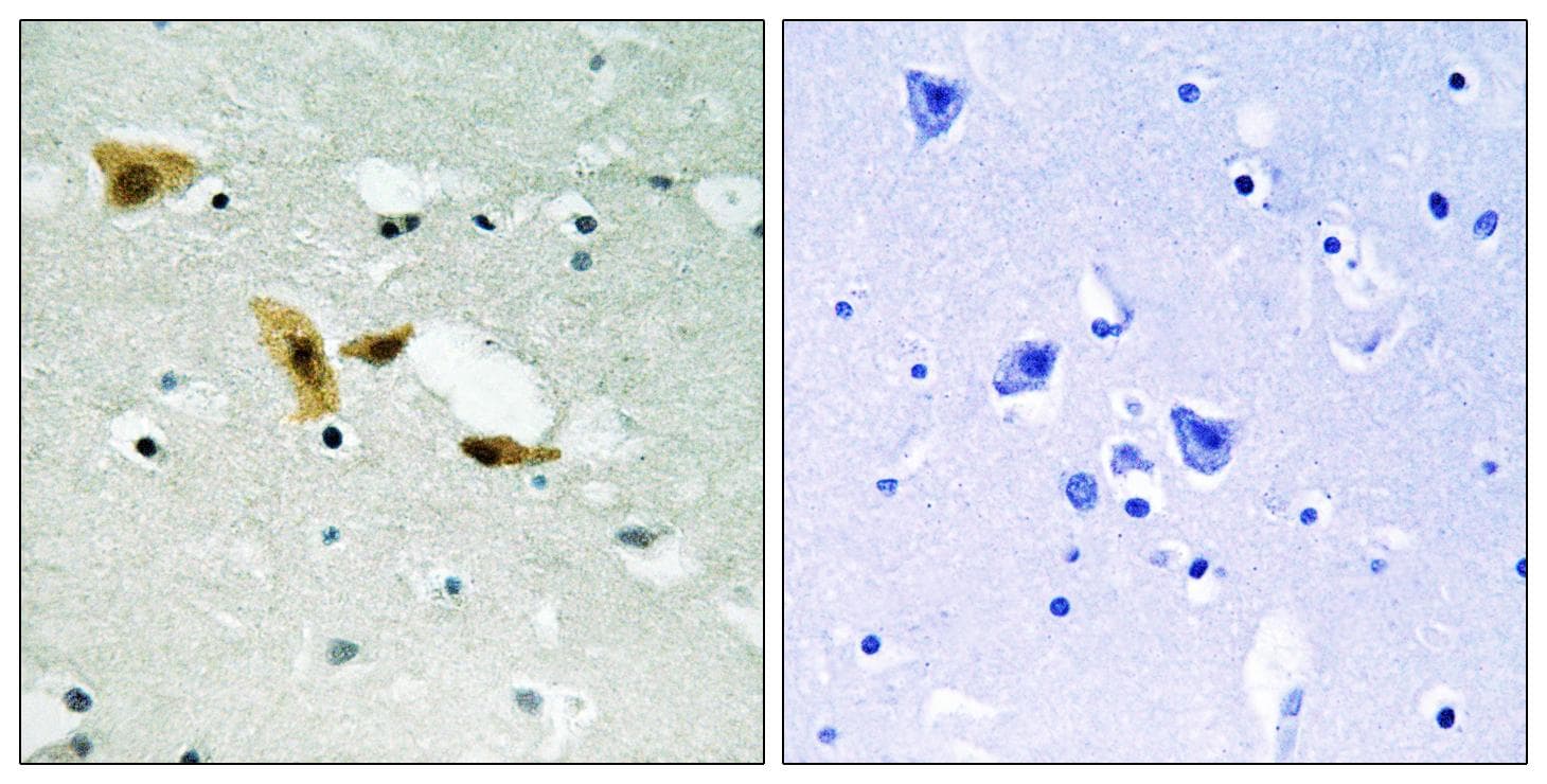 APLF / PALF Antibody (p116)