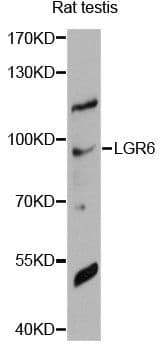 Polyclonal Rabbit anti-Human LGR6 Antibody (WB)