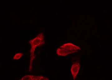 PABPC3 Antibody