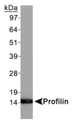 PFN1 / Profilin 1 Antibody (C-Terminus)