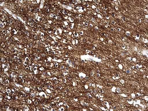 DBN1 / Drebrin Antibody (aa2-240, clone OTI4G4)