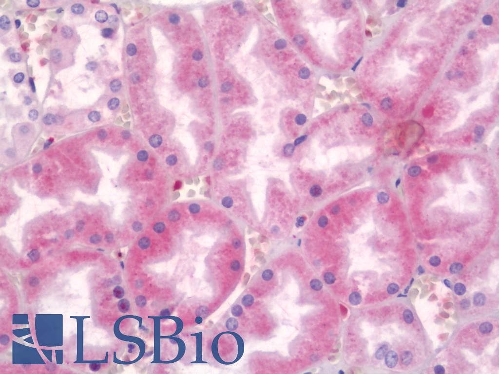 IHC-plus™ Polyclonal Rabbit anti-Human GJB1 / CX32 / Connexin 32 Antibody (aa66-115, IHC, WB)