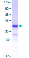 Human ITCH / AIP4 Protein (Recombinant GST, N-terminus)