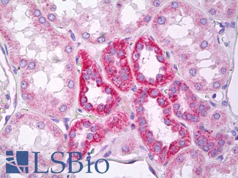 IHC-plus™ Polyclonal Rabbit anti-Human MARK2 Antibody (aa10-59, IHC, IF, WB)