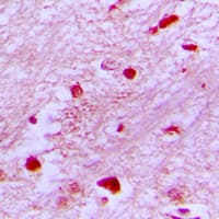 E2F2 Antibody (Internal)