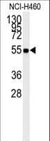 PathPlus™ ALDH1A1 / ALDH1 Antibody
