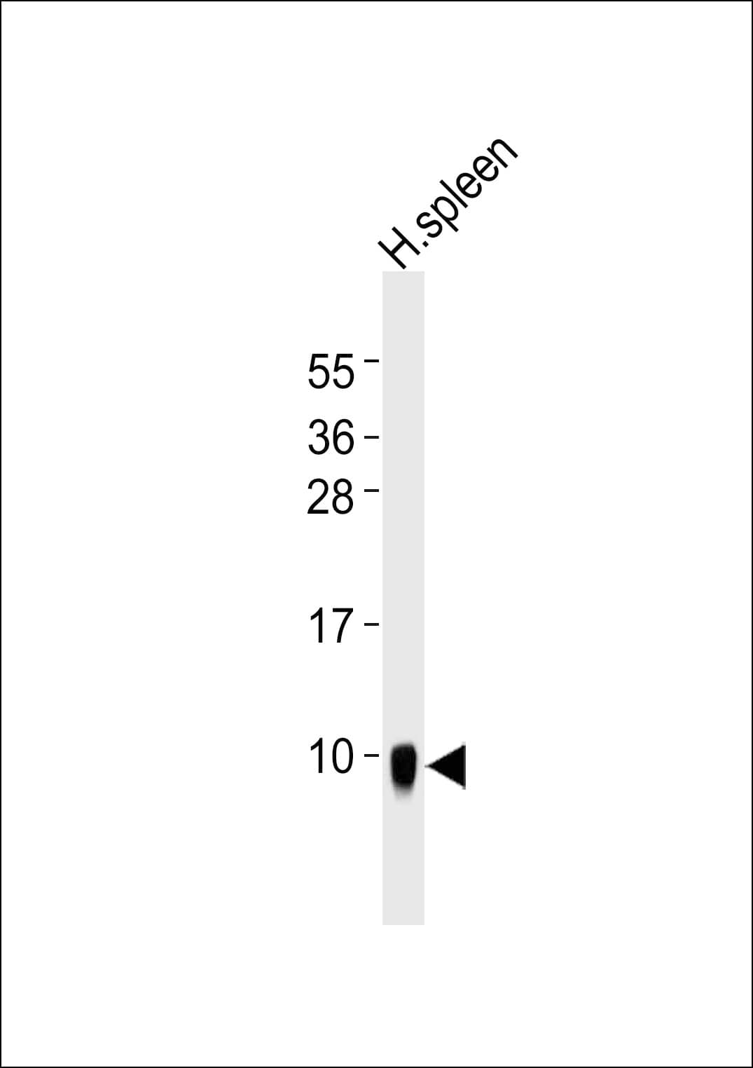 DEFA1 / Defensin Alpha 1 Antibody