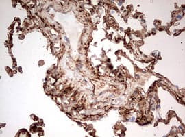 Monoclonal Mouse anti-Human GAPDH Antibody (clone OTI2F8, IHC, WB)