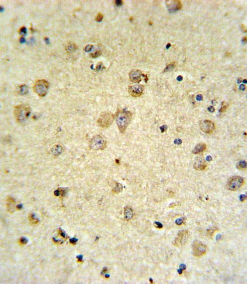 MAP4K3 / GLK Antibody (aa31-283)