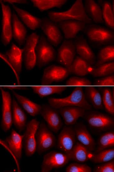 IHC-plus™ PSMA5 Antibody