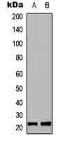 Polyclonal Rabbit anti-Human MRPL35 Antibody (Internal, WB)