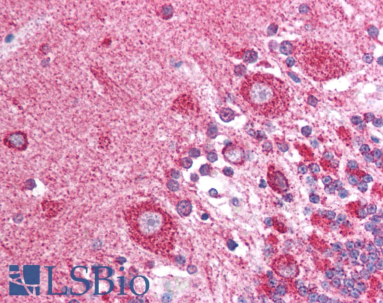 IHC-plus™ GOPC / PIST Antibody