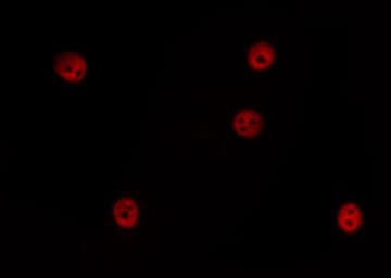 Polyclonal Rabbit anti-Human CCNE1 / Cyclin E1 Antibody (IHC, IF, WB)