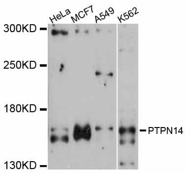 Polyclonal Rabbit anti-Human PTPN14 / PEZ Antibody (WB)
