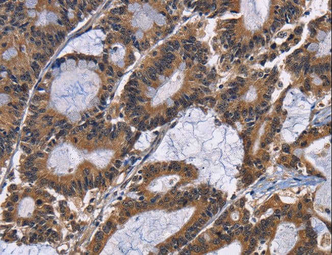 EPHB6 / EPH Receptor B6 Antibody