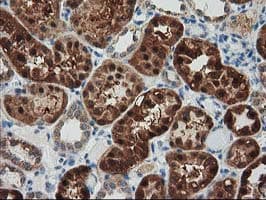 GRHPR / Glyoxylate Reductase Antibody (clone OTI1A9, Carrier-free)