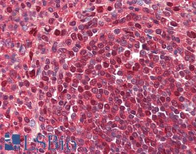 IHC-plus™ Polyclonal Rabbit anti-Human PSMB8 / LMP7 Antibody (IHC, IF, WB)