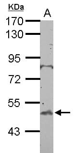 BTBD10 / GMRP-1 Antibody