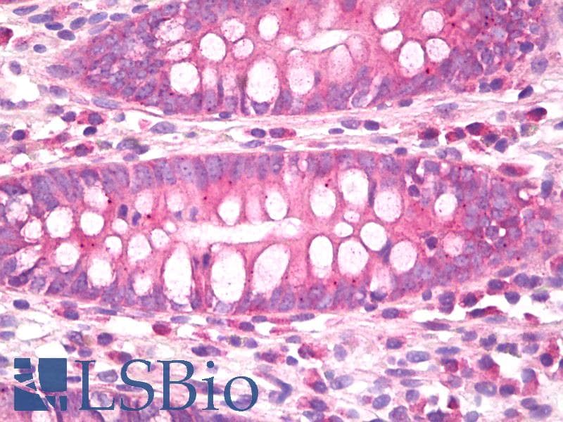 IHC-plus™ CNR1 / CB1 Antibody