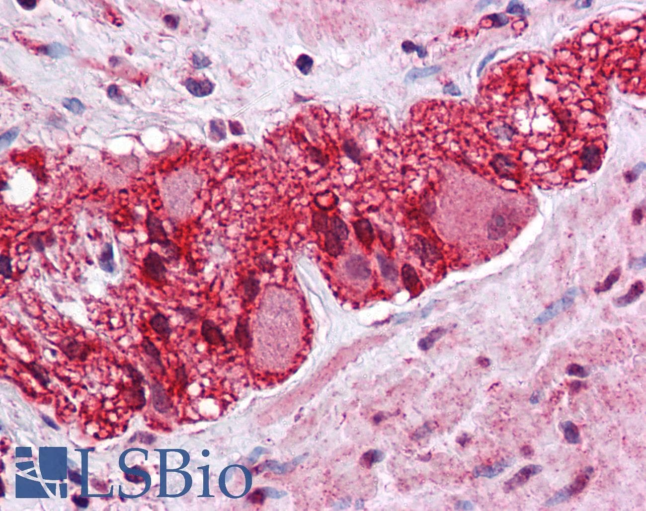 IHC-plus™ LMBRD1 Antibody