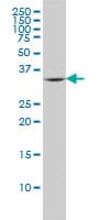 FcERI / Fc Epsilon RI Antibody (clone 2C12-3B6)