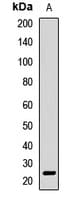 Polyclonal Rabbit anti-Human APCS / Serum Amyloid P / SAP Antibody (IHC, WB)